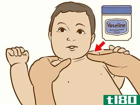 Image titled Treat Neck Rashes for Your Baby Step 2