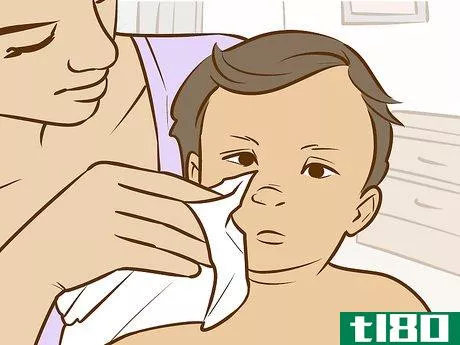 Image titled Treat Neck Rashes for Your Baby Step 8