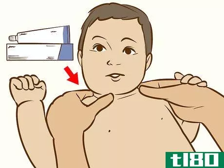 Image titled Treat Neck Rashes for Your Baby Step 3