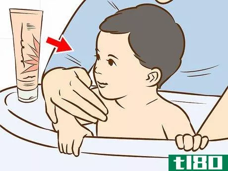 Image titled Treat Neck Rashes for Your Baby Step 1