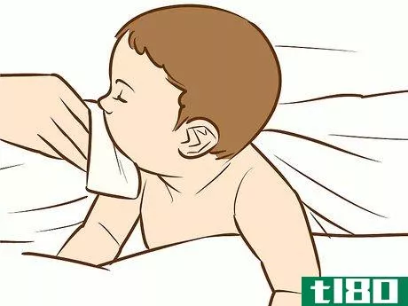 Image titled Treat Neck Rashes for Your Baby Step 4