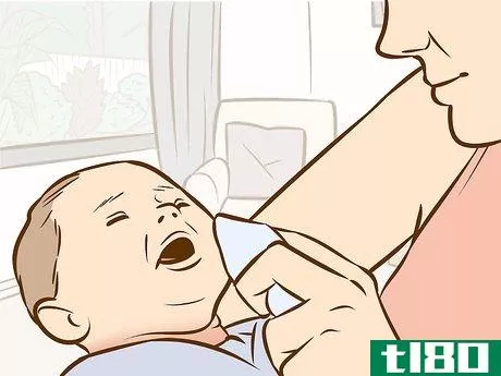 Image titled Treat Neck Rashes for Your Baby Step 14