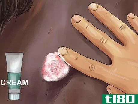 Image titled Treat Skin Disorders in Horses Step 14