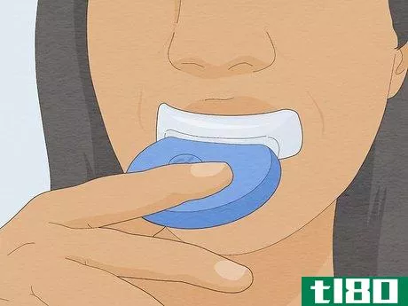 Image titled Whiten Your Teeth Without Spending a Lot of Money Step 1