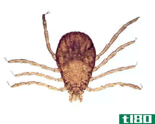 It's important to remove all parts of a tick from the bite.