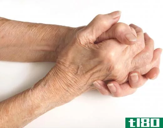 Boswellia may be used to treat arthritis.