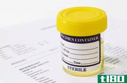 Urine samples are often used as part of biomonitoring.