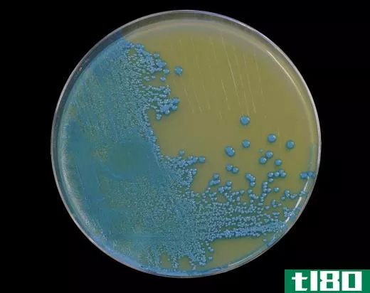 Bacteria in a petri dish.
