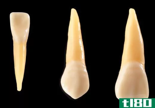 Composite can be used to repair a tooth with a minor chip.
