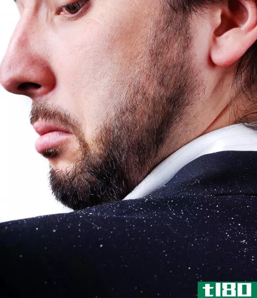 Signs of dandruff include an itchy scalp and white flakes that fall from the head.