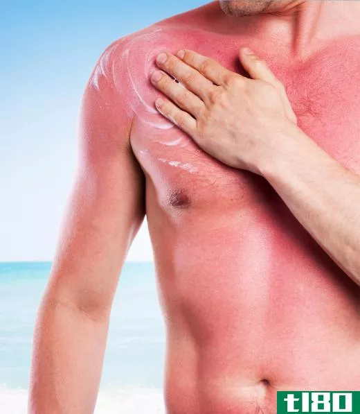 Sunburns and windburns often appear red and inflamed.