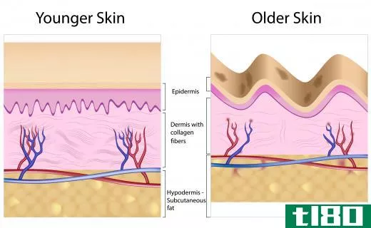 A diagram of younger skin and older skin showing how the decrease in collagen can lead to wrinkles.