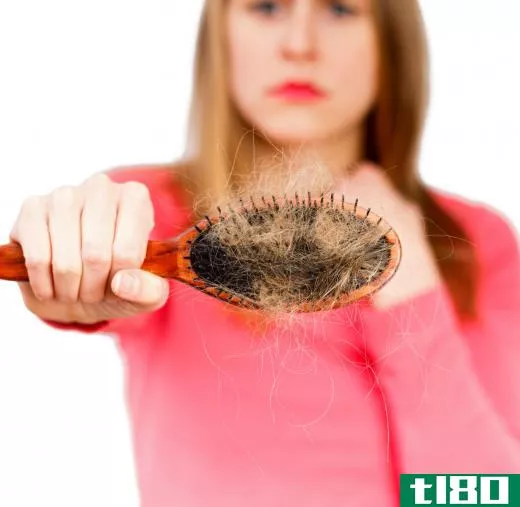Female pattern baldness in women results in hair loss all over the head.