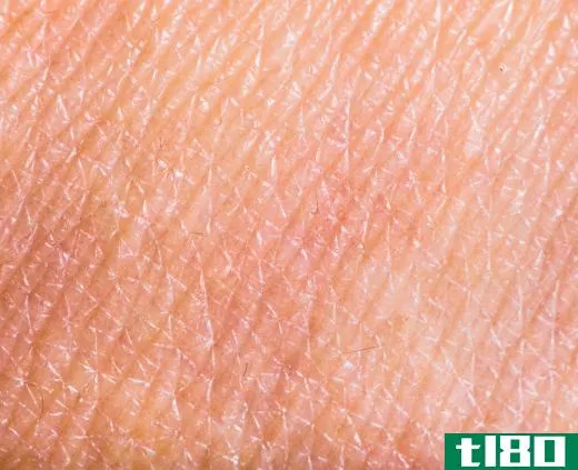 Human skin has many hair follicles which can become clogged.