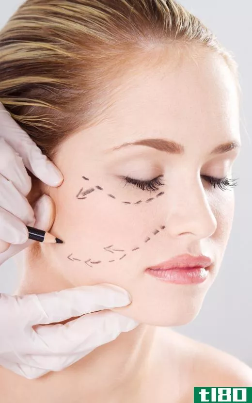 A woman preparing to get cosmetic surgery for dimples.