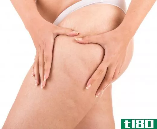 Some lotions are used to reduce the dimpled appearance of cellulite.