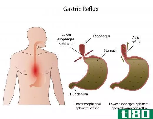 Persistent bad breath may be the cause of an underlying condition like gastric reflux.
