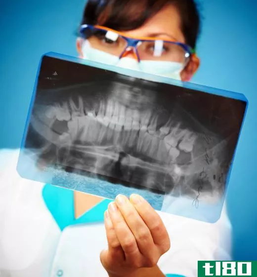 Using an ultrasound toothbrush may help remove debris from deep below the gum line and prevent tooth decay.