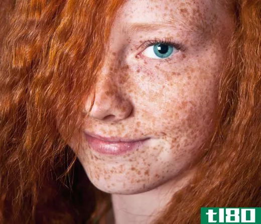 Fair skin is often accompanied by red hair and freckles.
