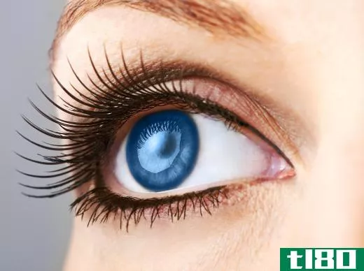 Eye whitening may be performed to reduce the appearance of veins on the white of the eye.