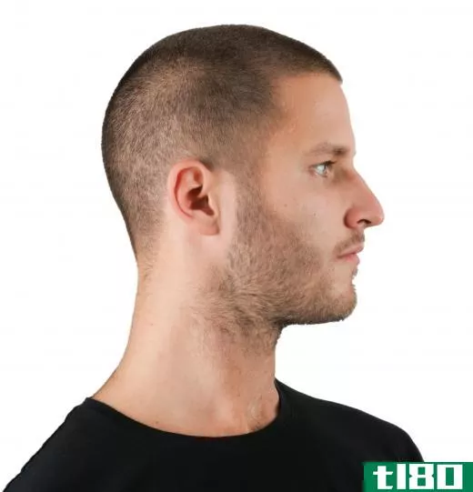 Beard stubble can extend to the neck.