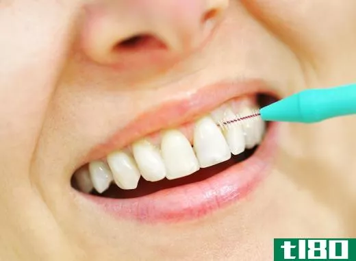 Teeth should be flossed daily, despite professional cleaning sessions.