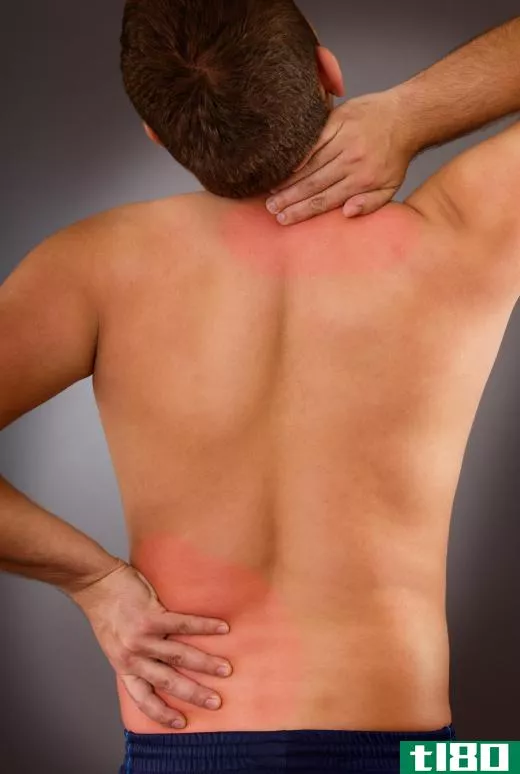 Chicken collagen may be useful in treating back and neck pain.