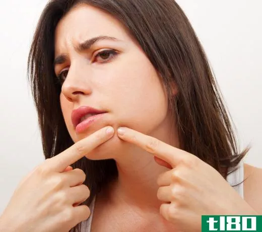 Some individuals who use isopropyl palmitate may experience an increase in blackheads due to clogged pores.