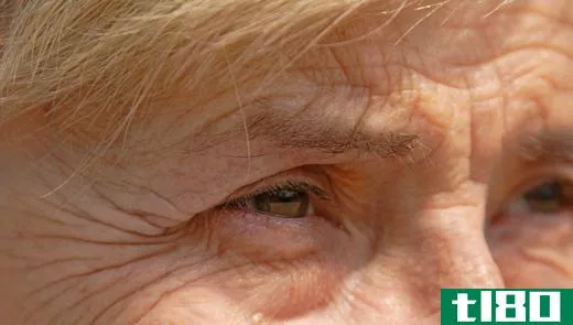 A woman with wrinkles around her eyes.