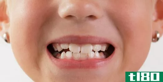 Children start to lose their baby teeth by about age 6.