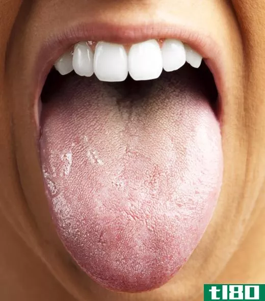 Regular tongue brushing removes harmful odor causing bacteria.