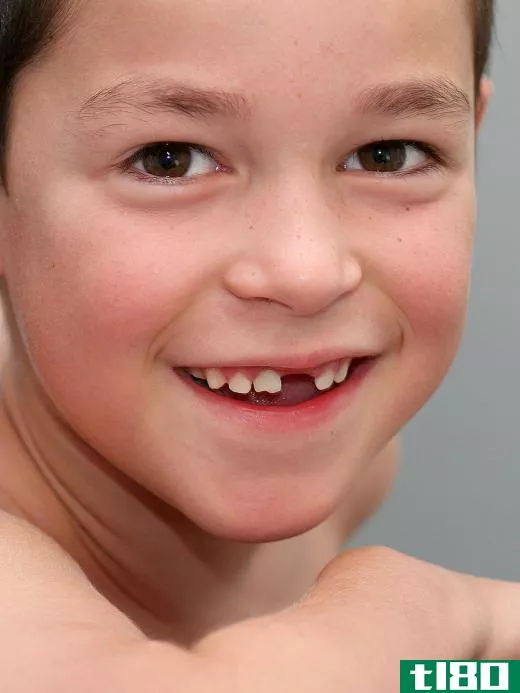 Boy with missing tooth.