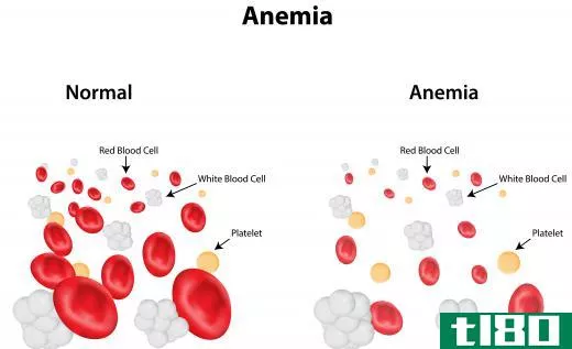 Anemia can contribute to gray hair as a result of an iron deficiency in the blood.