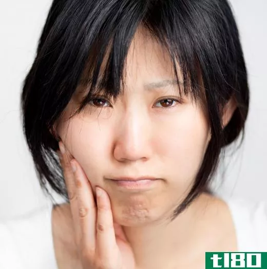 When wisdom teeth become impacted, they are typically removed.