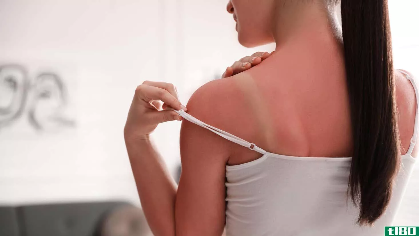 Image for article titled How to Tell If Your Sunburn Might Actually Need Medical Attention