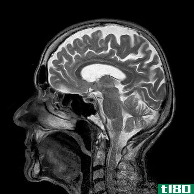 illustration of a man's brain inside his head