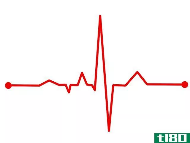 illustration of an electrocardiogram