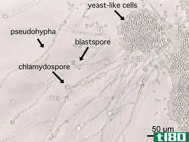 节孢子(arthrospores)和厚垣孢子(chlamydospore)的区别