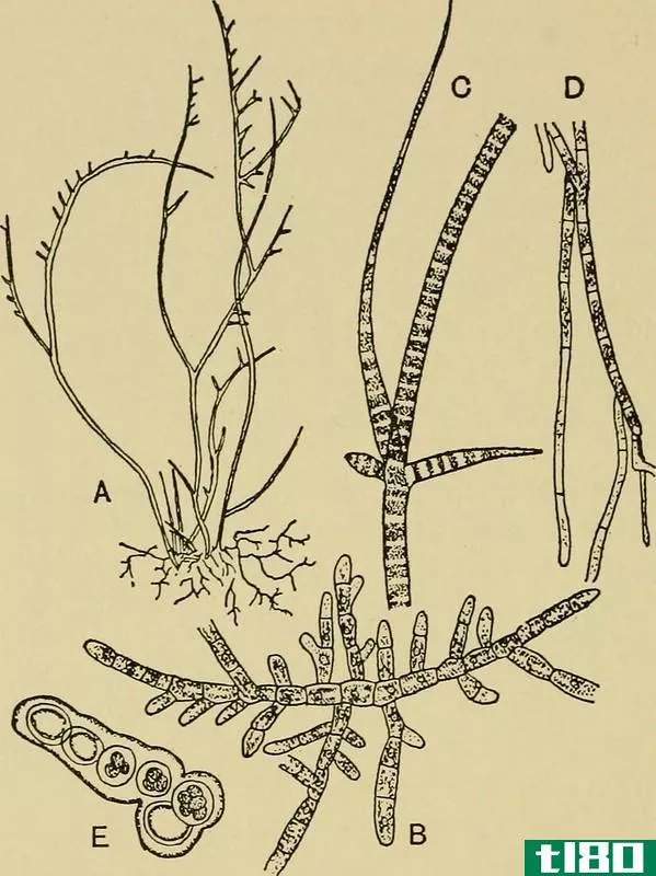 共核细胞(coenocytic)和异毛(heterotrichous)的区别