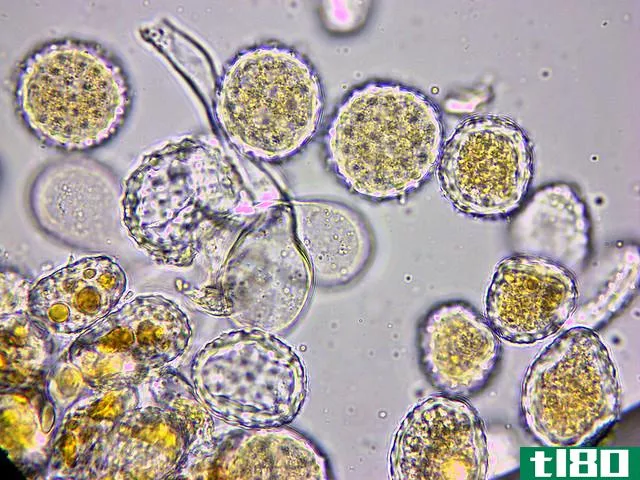 脲孢子(uredospore)和柄孔(teliospore)的区别