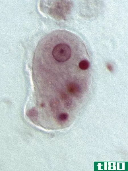 变形虫(amoeba)和内阿米巴(entamoeba)的区别