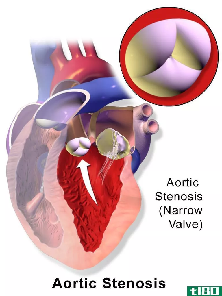 二尖瓣(mitral valve)和主动脉瓣(aortic valve)的区别