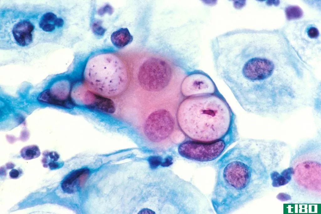 支原体(mycopla**a)和衣原体(chlamydia)的区别