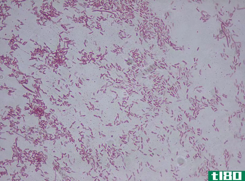 铜绿假单胞菌(pseudomonas aeruginosa)和荧光假单胞菌(pseudomonas fluorescens)的区别