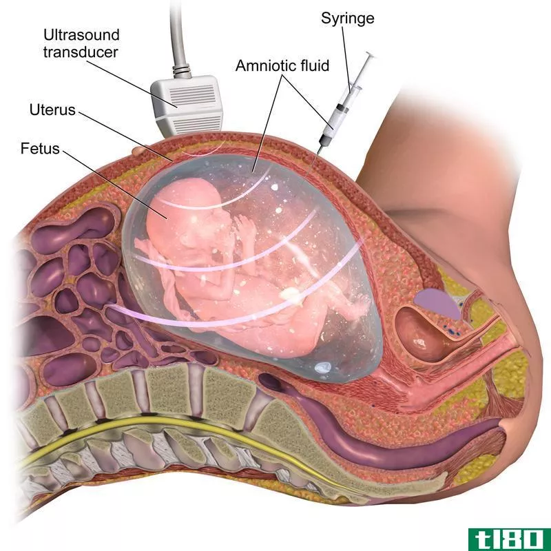 羊膜穿刺术(amniocentesis)和绒毛取样(chorionic villus sampling)的区别