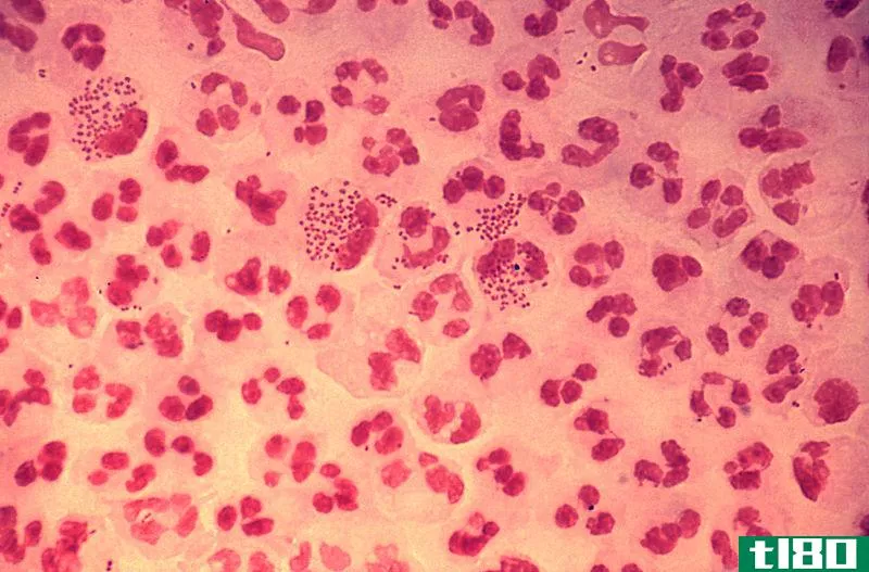 淋病奈瑟菌(neisseria gonorrhoeae)和脑膜炎奈瑟菌(neisseria meningitidis)的区别