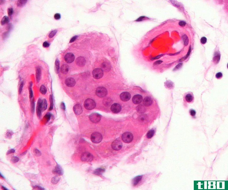 间质细胞(leydig cells)和支持细胞(sertoli cells)的区别