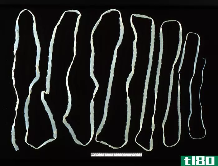 真涡虫(planarians)和绦虫(tapeworms)的区别