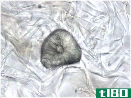 纤维(fibres)和石细胞(sclereids)的区别
