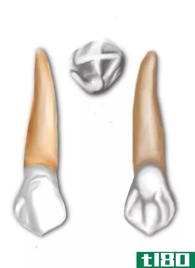 上颌(maxillary)和下颌尖牙(mandibular canine)的区别